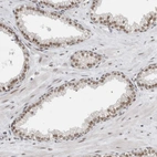 Immunohistochemical staining of human prostate shows moderate nuclear positivity in glandular cells.