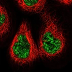 Immunofluorescent staining of human cell line A-431 shows localization to nuclear speckles.