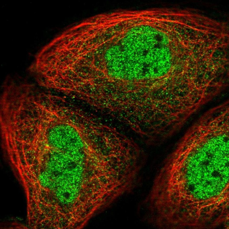 Anti-UHRF2 Antibody
