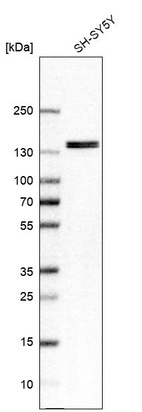 Western blot analysis in human cell line SH-SY5Y.