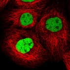 Immunofluorescent staining of human cell line A-431 shows localization to nucleoplasm.