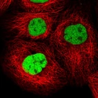 Immunofluorescent staining of human cell line A-431 shows localization to nucleoplasm.
