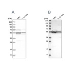 Western blot analysis using Anti-DDX6 antibody HPA026644 (A) shows similar pattern to independent antibody HPA024201 (B).