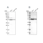 Western blot analysis using Anti-DDX6 antibody HPA026644 (A) shows similar pattern to independent antibody HPA024201 (B).