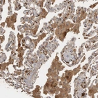 Anti-VEPH1 Antibody