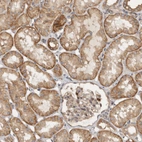 Immunohistochemical staining of human Kidney shows strong membranous positivity in cells in tubules.