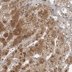 Immunohistochemical staining of human Adrenal gland shows strong membranous and cytoplasmic positivity in glandular cells.
