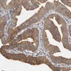 Immunohistochemical staining of human Fallopian tube shows moderate membranous positivity in glandular cells.
