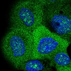 Immunofluorescent staining of human cell line A-431 shows localization to nucleus, nucleoli & cytosol.