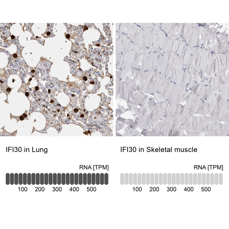 Anti-IFI30 Antibody