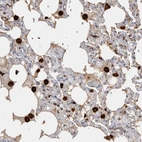 Immunohistochemical staining of human lung shows strong cytopalsmic positivity in macrophages.