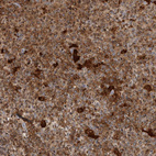 Immunohistochemical staining of human tonsil shows strong cytoplasmic positivity in a subset of non-germinal center cells.