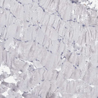 Immunohistochemical staining of human skeletal muscle shows no positivity in myocytes as expected.