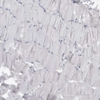 Immunohistochemical staining of human skeletal muscle shows no positivity in myocytes as expected.