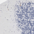 Immunohistochemical staining of human cerebellum shows no positivity in Purkinje cells as expected.
