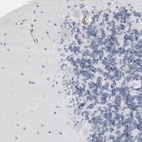 Immunohistochemical staining of human cerebellum shows no positivity in Purkinje cells as expected.