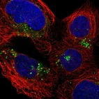 Immunofluorescent staining of human cell line A-431 shows localization to cell junctions & vesicles.