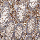Immunohistochemical staining of human colon shows strong cytoplasmic positivity in lymphoid cells.