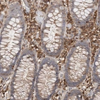 Immunohistochemical staining of human colon shows strong cytoplasmic positivity in lymphoid cells.