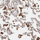 Immunohistochemical staining of human lung shows strong cytoplasmic positivity in macrophages.
