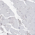 Immunohistochemical staining of human skeletal muscle shows no positivity in myocytes as expected.