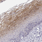 Immunohistochemical staining of human esophagus shows strong granular cytoplasmic positivity in squamous epithelial cells.