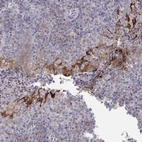 Immunohistochemical staining of human tonsil shows moderate granular cytoplasmic positivity in squamous epithelial cells.