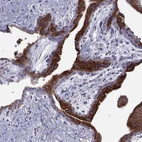 Immunohistochemical staining of human placenta shows strong granular cytoplasmic positivity in trophoblastic cells.