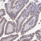 Immunohistochemical staining of human small intestine shows weak granular cytoplasmic positivity in glandular cells.