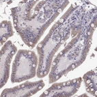 Immunohistochemical staining of human small intestine shows weak granular cytoplasmic positivity in glandular cells.
