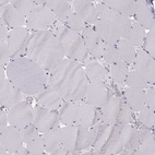 Immunohistochemical staining of human skeletal muscle shows no positivity in myocytes as expected.