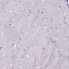 Immunohistochemical staining of human skeletal muscle shows no positivity in myocytes as expected.