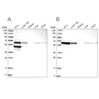 Western blot analysis using Anti-ERO1A antibody HPA026653 (A) shows similar pattern to independent antibody HPA030053 (B).