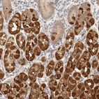 Immunohistochemical staining of human stomach shows moderate to strong cytoplasmic positivity in glandular cells.