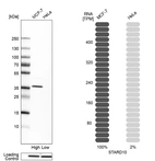 Western blot analysis in human cell lines MCF-7 and HeLa using Anti-STARD10 antibody. Corresponding STARD10 RNA-seq data are presented for the same cell lines. Loading control: Anti-HSP90B1.