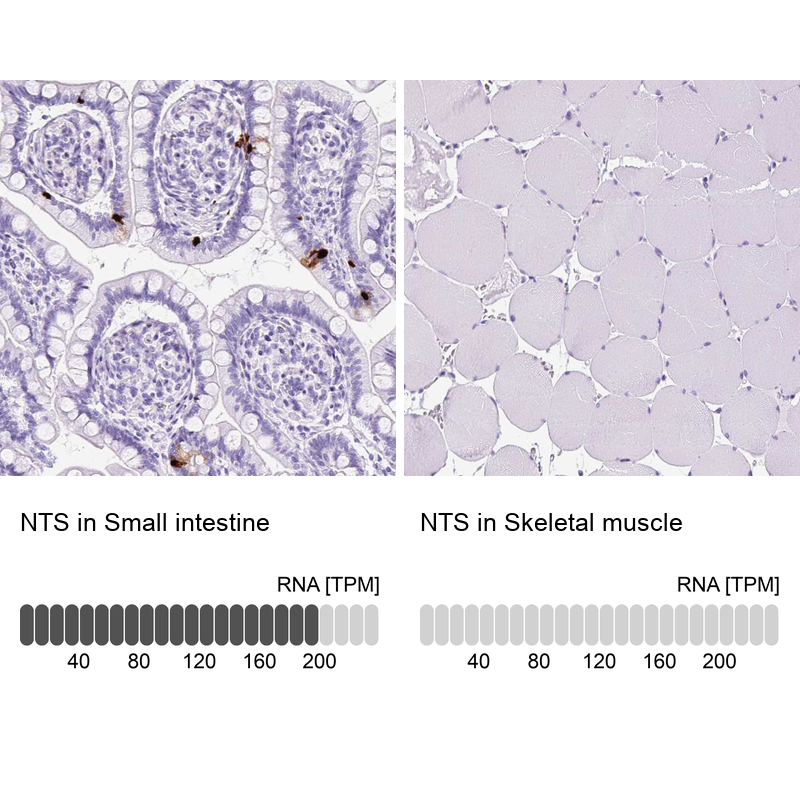 Anti-NTS Antibody