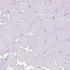 Immunohistochemical staining of human skeletal muscle shows no positivity in striated muscle fibers as expected.