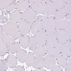 Immunohistochemical staining of human skeletal muscle shows no positivity in striated muscle fibers as expected.