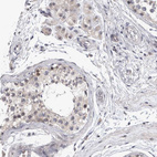 Immunohistochemical staining of human testis shows moderate positivity in nucleoli and nucleus in cells in seminiferous ducts and Leydig cells.