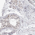 Immunohistochemical staining of human testis shows moderate positivity in nucleoli and nucleus in cells in seminiferous ducts and Leydig cells.