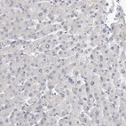 Immunohistochemical staining of human liver shows no nuclear positivity in hepatocytes as expected.
