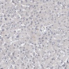 Anti-RBM28 Antibody