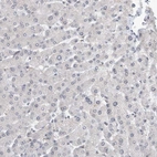 Immunohistochemical staining of human liver shows no nuclear positivity in hepatocytes as expected.