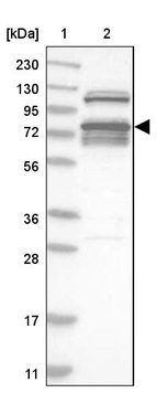 Lane 1: Marker [kDa] 230, 130, 95, 72, 56, 36, 28, 17, 11_br/_Lane 2: Human cell line RT-4