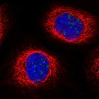 Immunofluorescent staining of human cell line A-431 shows localization to nucleoli.
