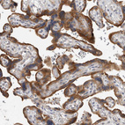 Anti-CLIP1 Antibody