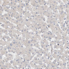 Immunohistochemical staining of human liver shows negative positivity in hepatocytes as expected.