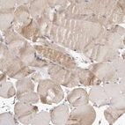 Immunohistochemical staining of human skeletal muscle shows weak cytoplasmic positivity in myocytes.