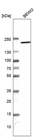 Western blot analysis in human cell line BEWO.