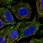 Immunofluorescent staining of human cell line SiHa shows localization to microtubule ends.